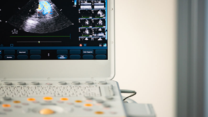 An ultrasound that is displaying the kidney of a patient